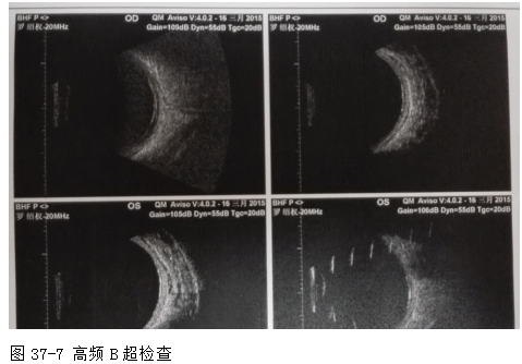 ZY016_196_1.gif